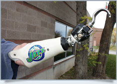 Peak Prosthetic Gallery Image: 