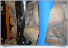 Peak Prosthetic Gallery Image: 