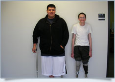 Peak Prosthetic Gallery Image: This is the description